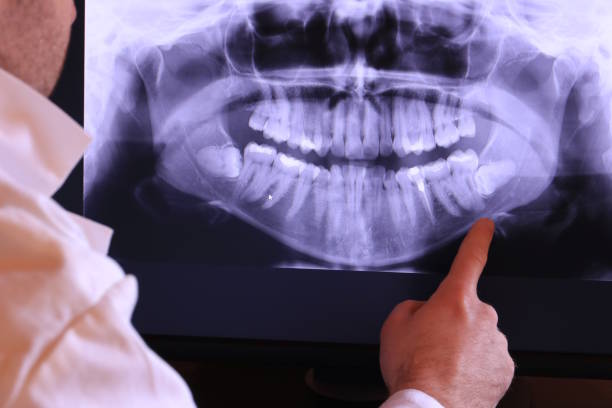 Best Urgent Tooth Repair  in Rosend, LA