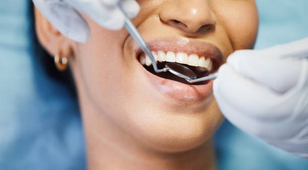 Best Emergency Tooth Extraction  in Rosend, LA