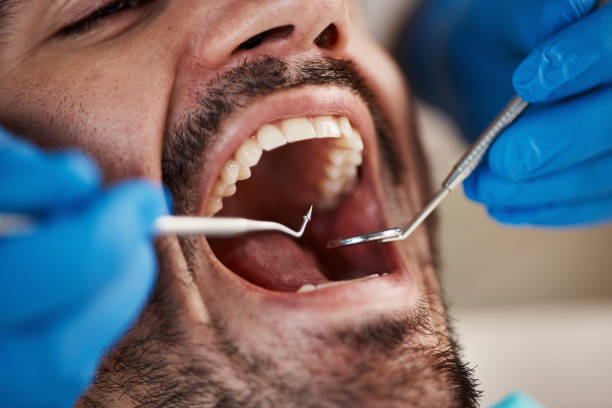 Best Emergency Dentist Near Me  in Rosend, LA