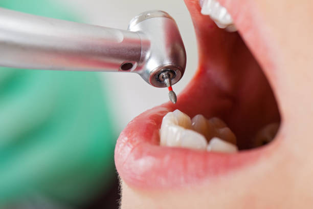 Best Tooth Infection Emergency Dentist  in Rosend, LA